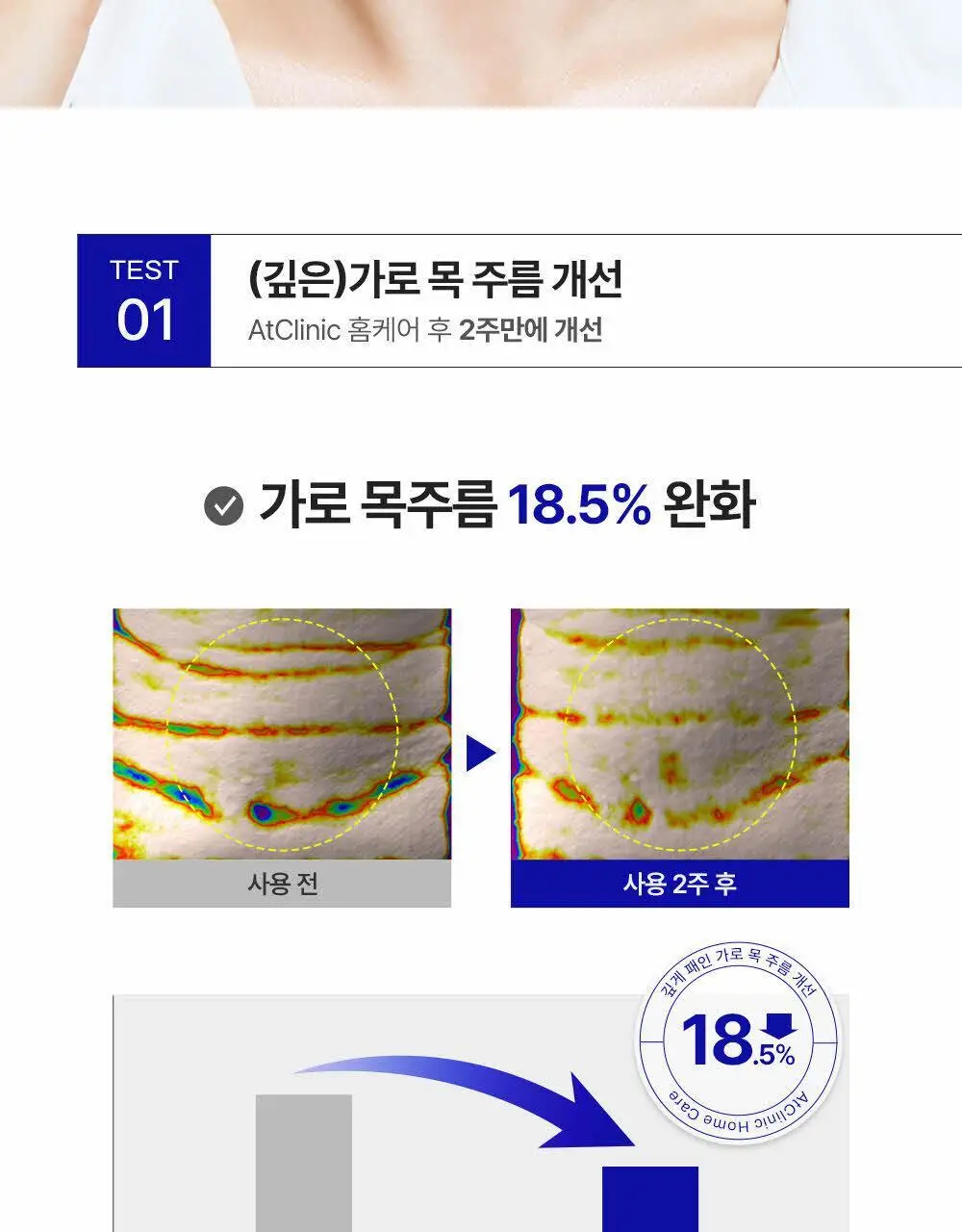 [목주름 개선] 도미나스 앳클리닉 레티놀 1600 넥 샷 목주름 세럼 30ml 상세페이지 11